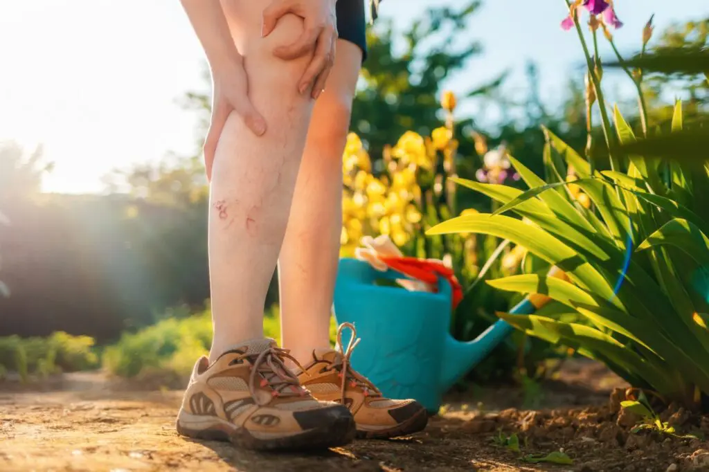 Women with leg veins in pain