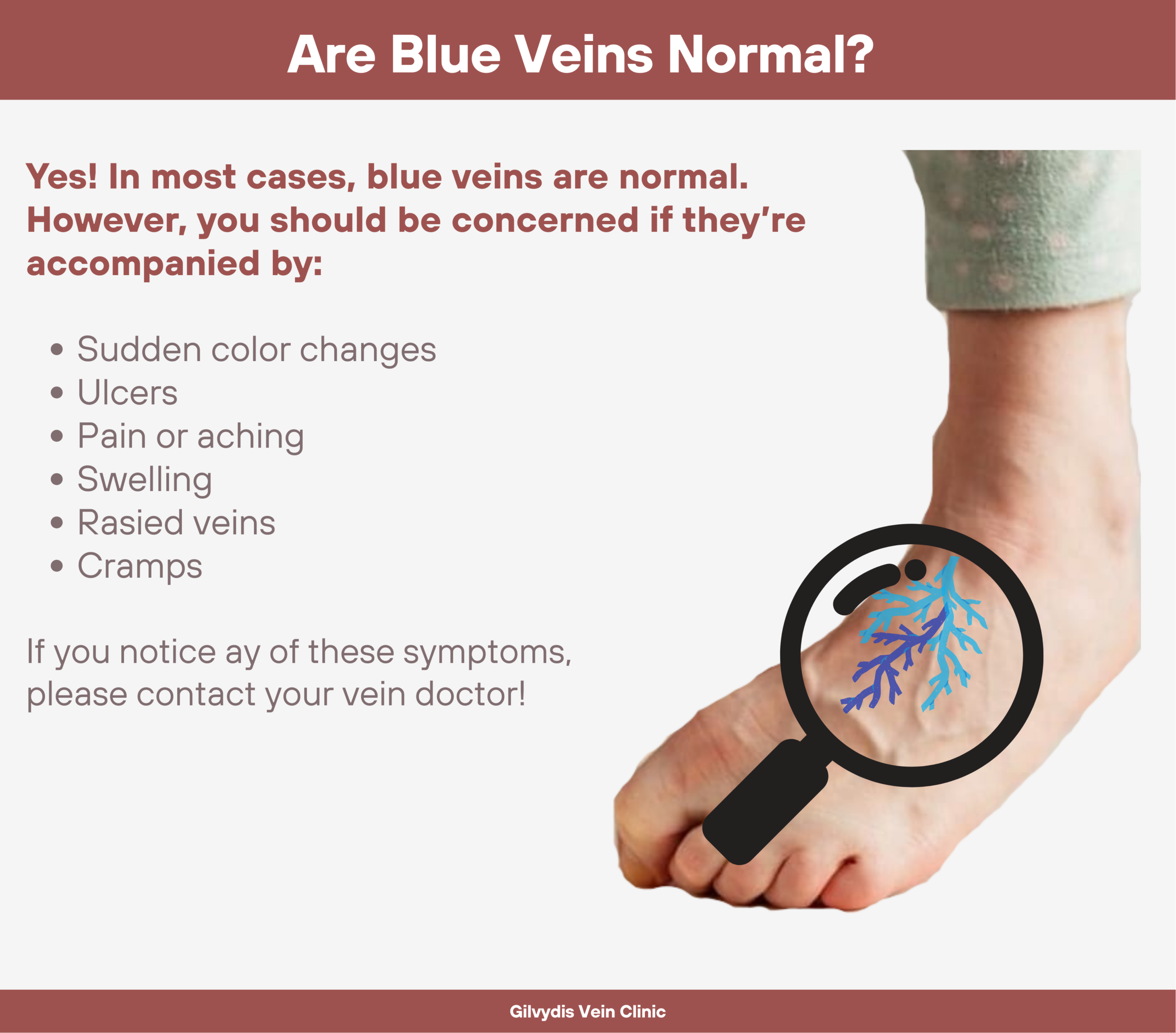 Are blue veins normal?