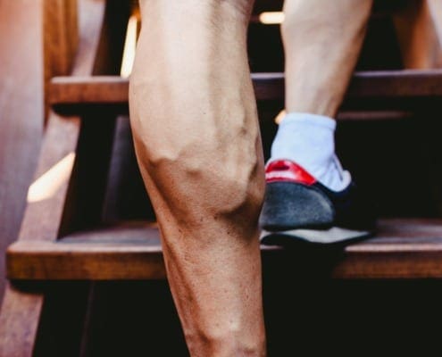 Healthy Legs showing veins walking up stairs