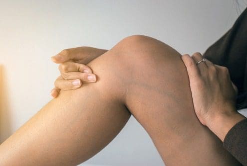 blue veins in leg