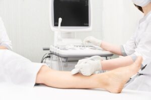 Treating Varicose Veins With Endovenous Laser Ablation (EVLA)