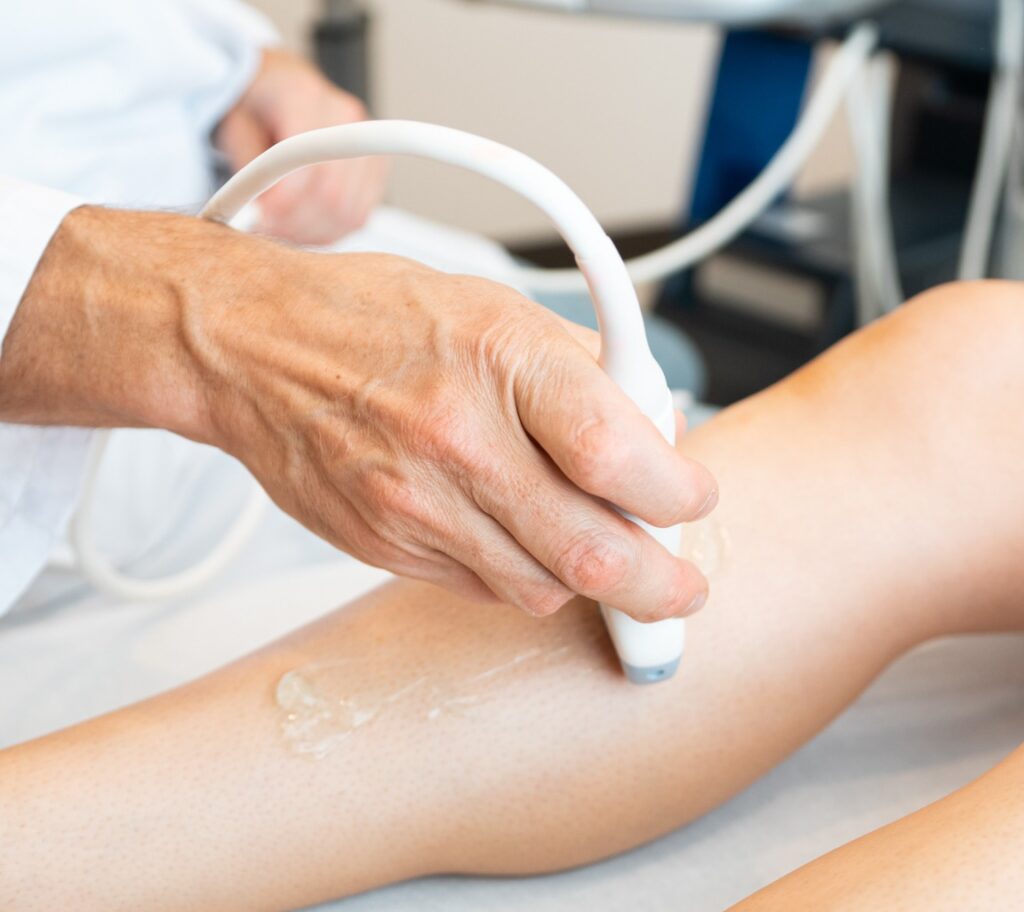 Ultrasound vein mapping machine used on a leg to examine veins